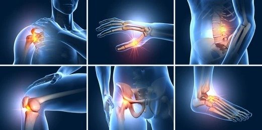 joint-set-six-painful-joints-medical-260nw-1857461167